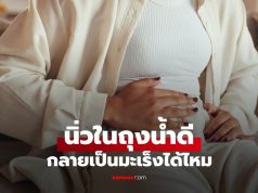 นิ่วในถุงน้ำดี กลายเป็นมะเร็งได้ไหม? สังเกต 4 สัญญาณเตือนที่ไม่ควรมองข้าม