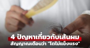 4 สัญญาณเตือนจาก “เส้นผม” ที่กำลังบอกว่า “ไต” ของคุณอาจไม่แข็งแรง